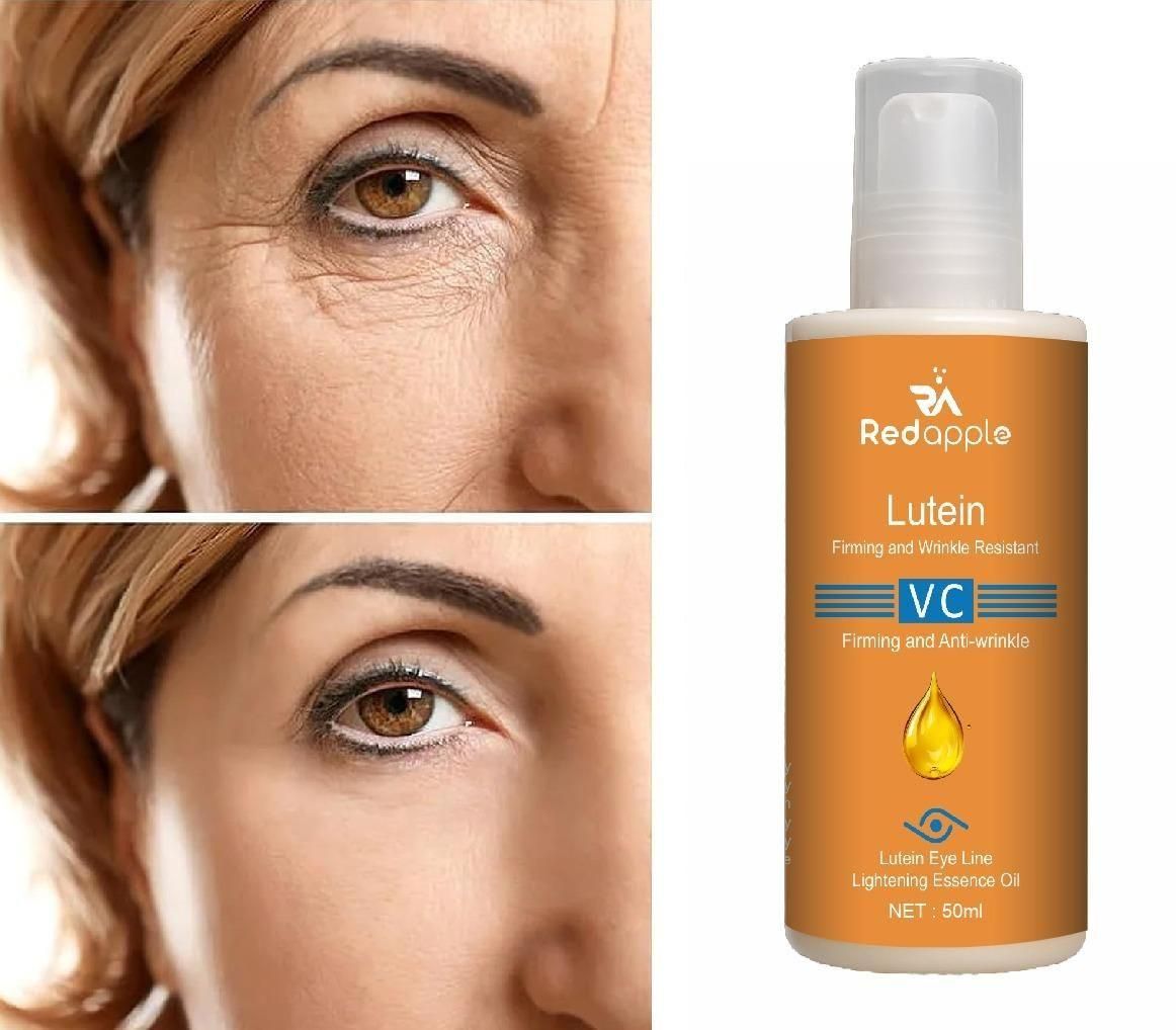 Dinkiss Lutein Eye Essence Oil || 🔥 BUY 1 GET 1 FREE  Anti- Wrinkle 50ML (Buy1 Get 1 Free)